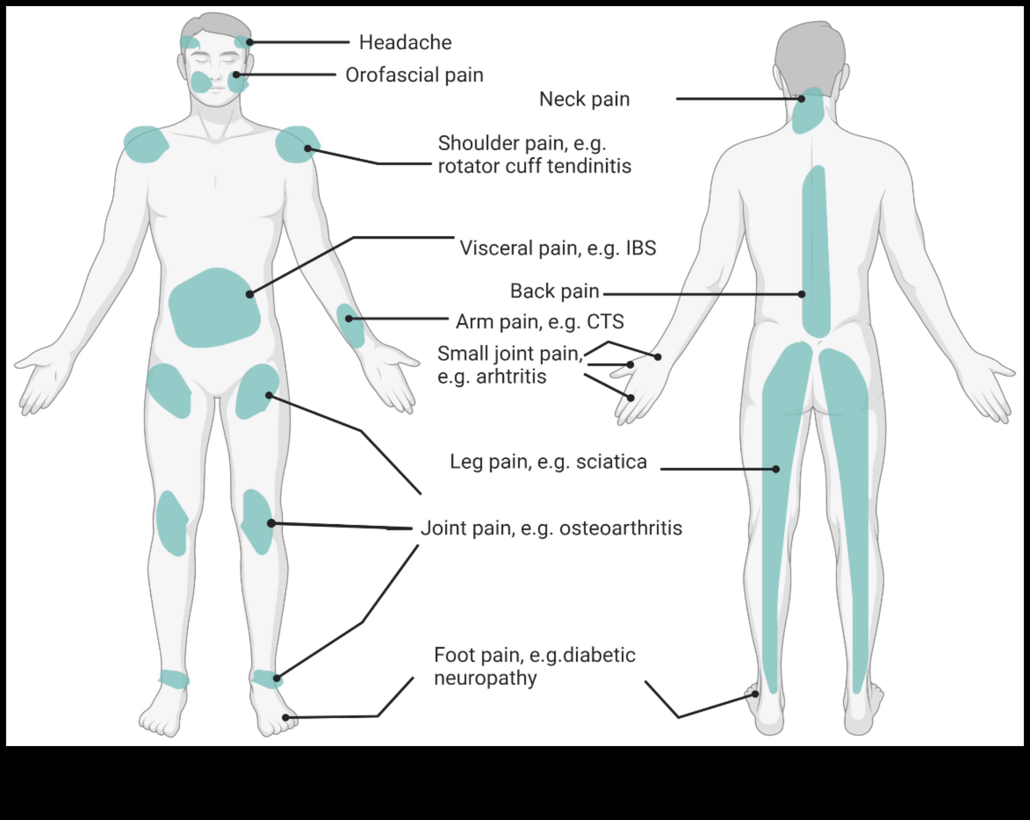 Protein ve Kronik Ağrı: Kapsamlı Bir Yaklaşım